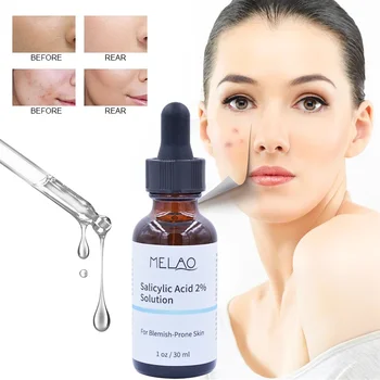 30ML Крем за лице за лечение на акне Салицилова киселина Акне белег Pimple Remover Избелване Изглаждане Грижа за кожата на лицето