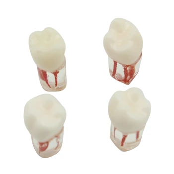 4PCS Модел на зъб за зъби Ендодонтски блок на кореновите канали RCT практика Пулпна кухина Стоматология Замяна на зъби от смола Инструменти за ендо обучение