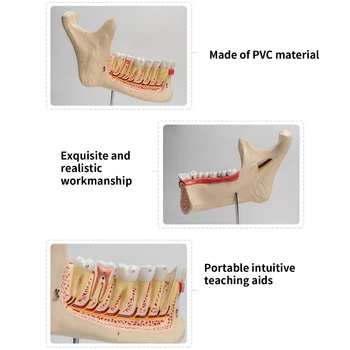 Трикратен човешки долен зъб анатомия модел медицинска учебна помощ